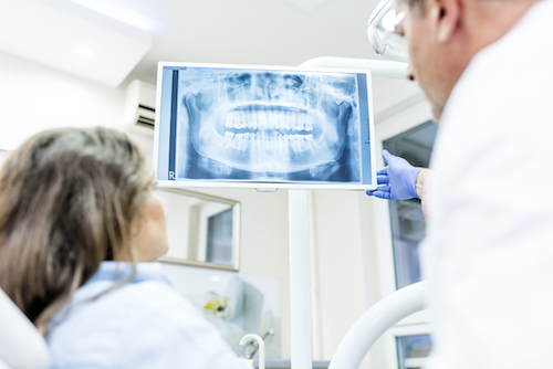 Image of a dentist and patient looking at a dental xray
